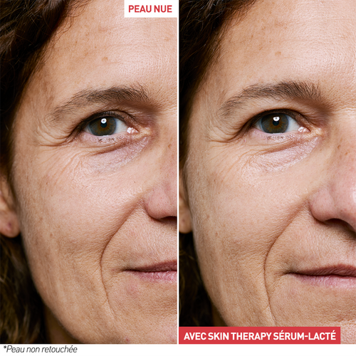 Skin Therapy – Sérum Lacté Nuit Multi-Perfecteur