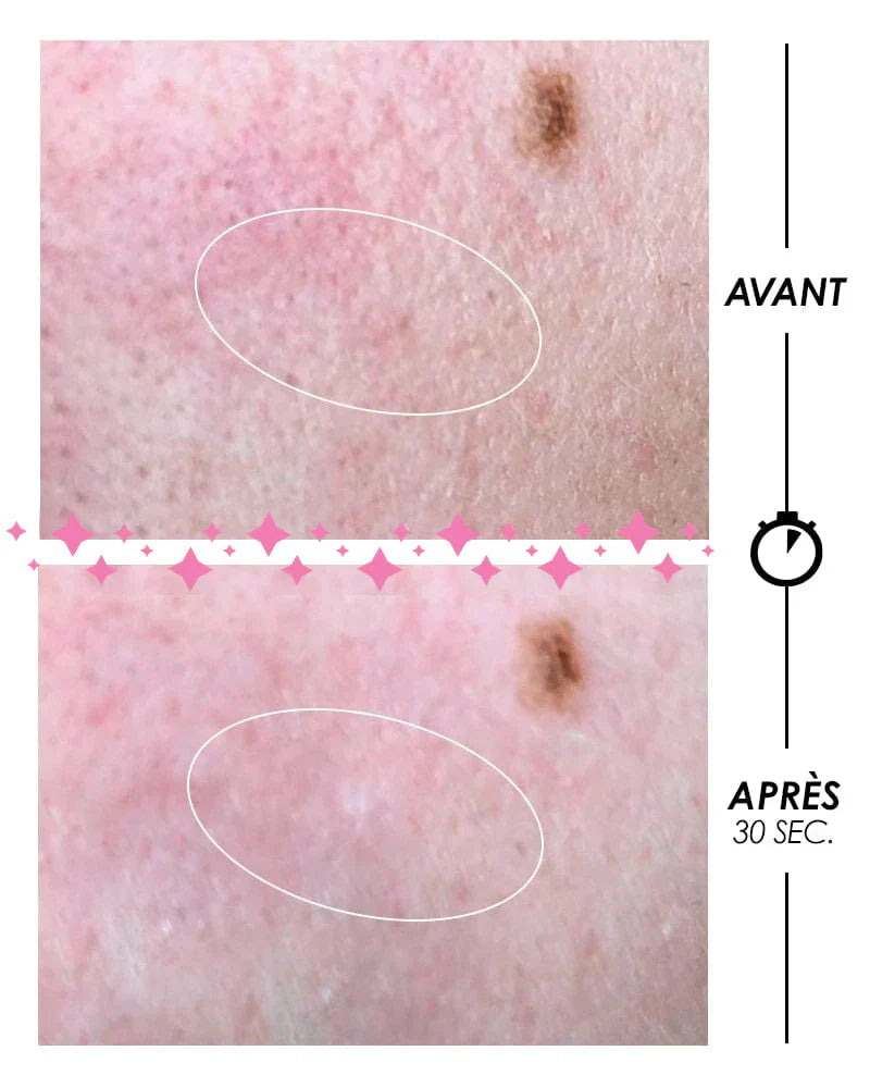 [ PSCHITT MAGIQUE Nouvelle Peau ] VISAGE Pschitt Cosmic
