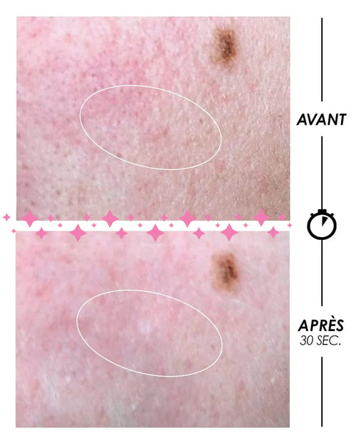 [ PSCHITT MAGIQUE Nouvelle Peau ] VISAGE Pschitt Cosmic