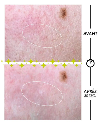 [ PSCHITT MAGIQUE Nouvelle Peau ] VISAGE