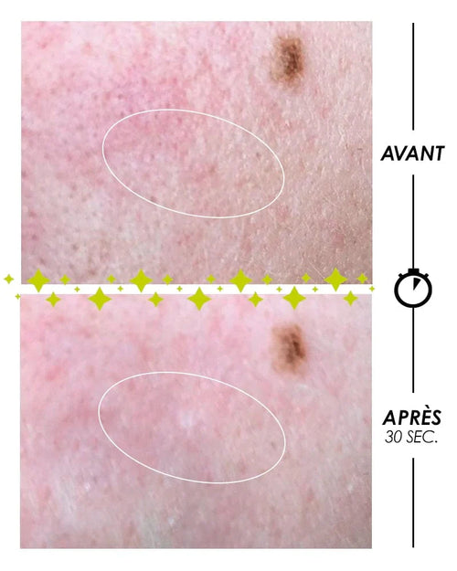 [ PSCHITT MAGIQUE Nouvelle Peau ] VISAGE