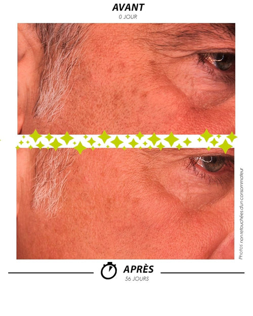 [ RITUEL CORRECTION ANTI-TACHES ]
