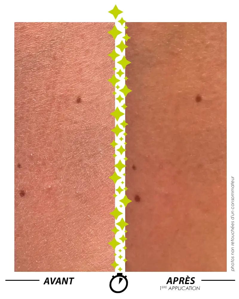 [ Formule ENSORCELANTE ANTI-PEAU DE CROCO ] SANS PARFUM